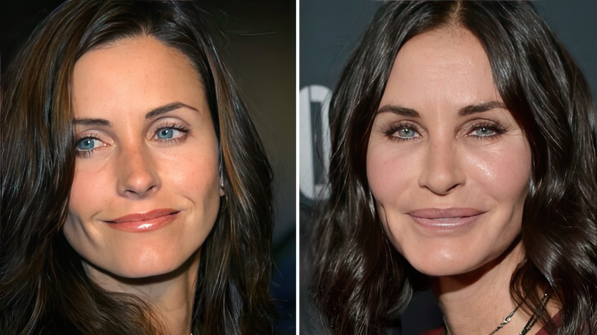 Courteney Cox przed i po operacjach plastycznych