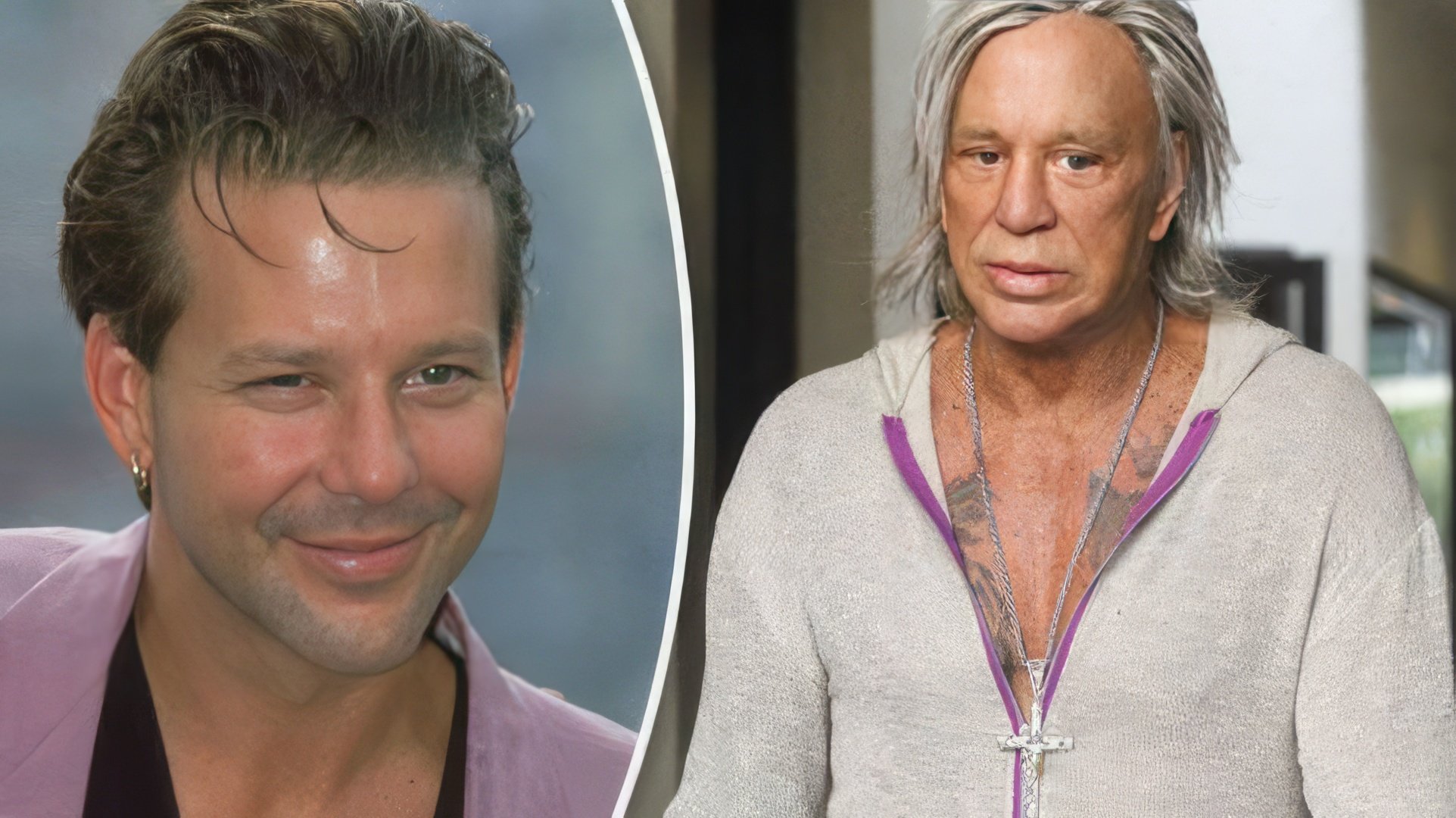 Mickey Rourke przed i po operacjach plastycznych