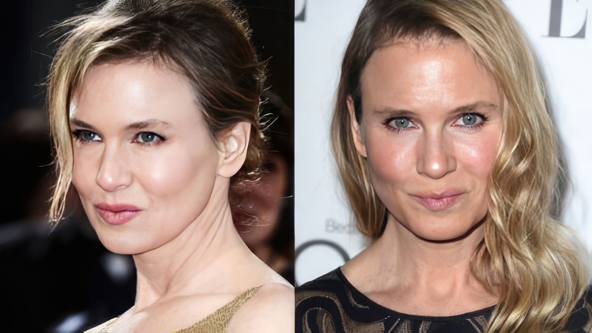 Renée Zellweger przed i po operacji