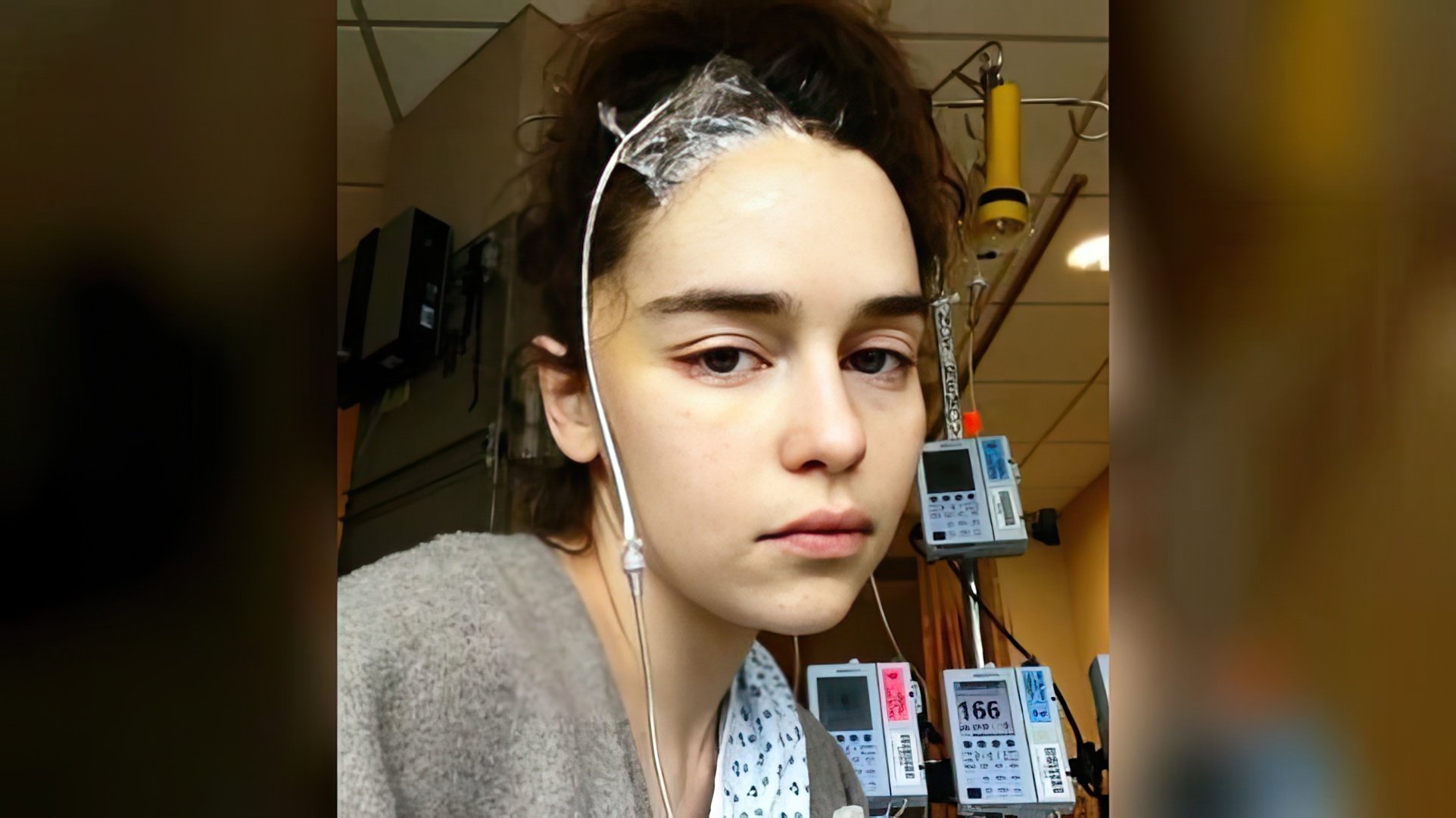 Z powodu tętniaka Emilia Clarke przeszła trzy operacje