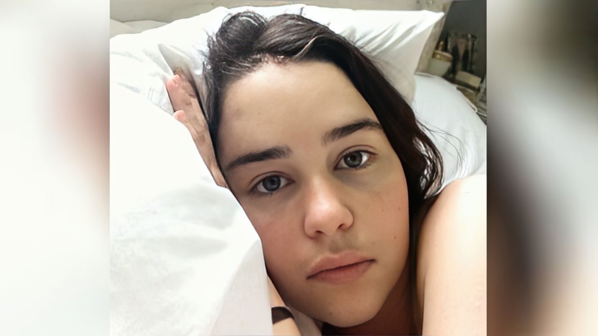 Emilia Clarke bez makijażu